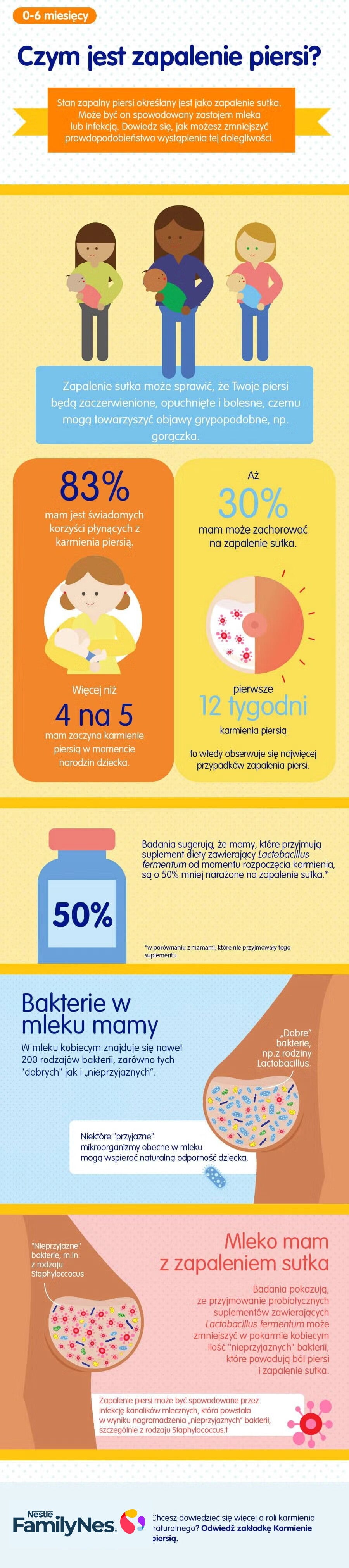 Czym jest zapalenie piersi?