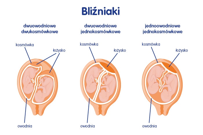 Bliźniaki jednojajowe - rodzaje