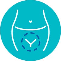 step2