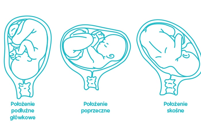 ulozenie-podluzne-poprzeczne-skosne_0.jpg