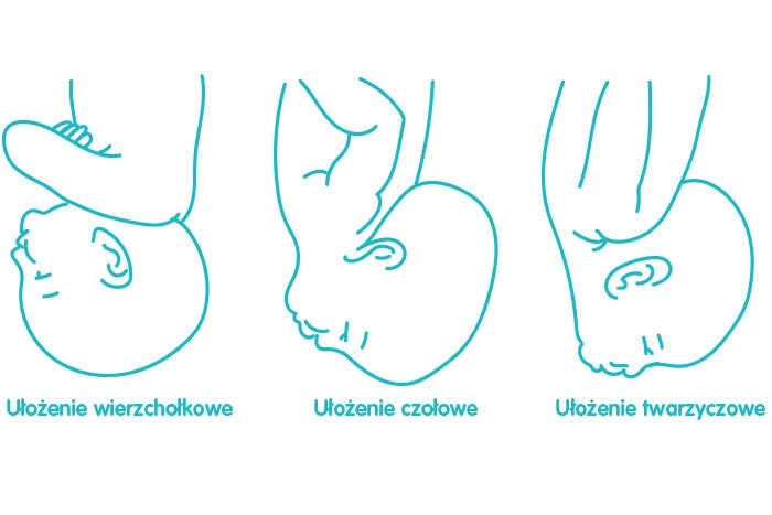 frontal facial apical arrangement