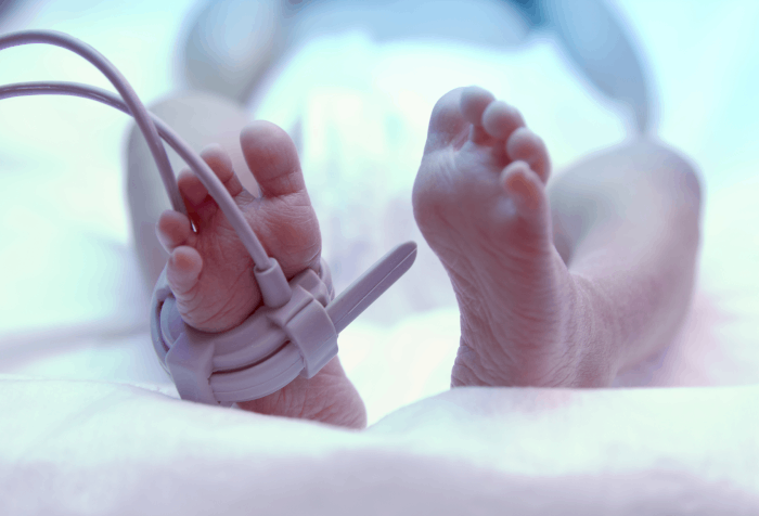 Wcześniactwo – stopy nowo narodzonego dziecka w inkubatorze