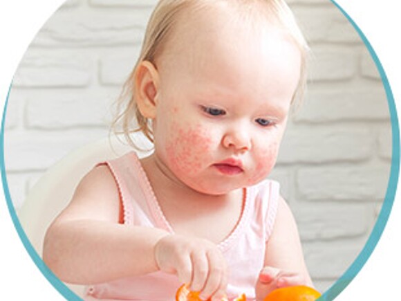 Alergia i nietolerancja pokarmowa u dziecka – co warto wiedzieć? Checklista