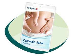 Cesarskie cięcie – poradnik