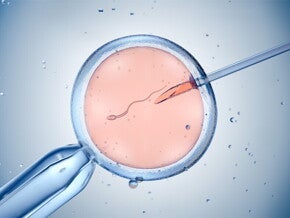 Procedura zapłodnienia pozaustrojowego realizowana dzięki wsparciu oferowanemu przez rządowy program in vitro
