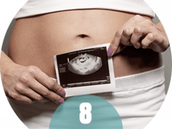 USG w 8 tygodniu ciąży