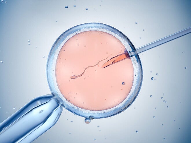 Procedura zapłodnienia pozaustrojowego realizowana dzięki wsparciu oferowanemu przez rządowy program in vitro | Nestlé FamilyNes Procedura zapłodnienia pozaustrojowego realizowana dzięki wsparciu oferowanemu przez rządowy program in vitro