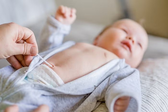 pielęgnacja kikuta pępowiny pielęgnacja kikuta pępowiny