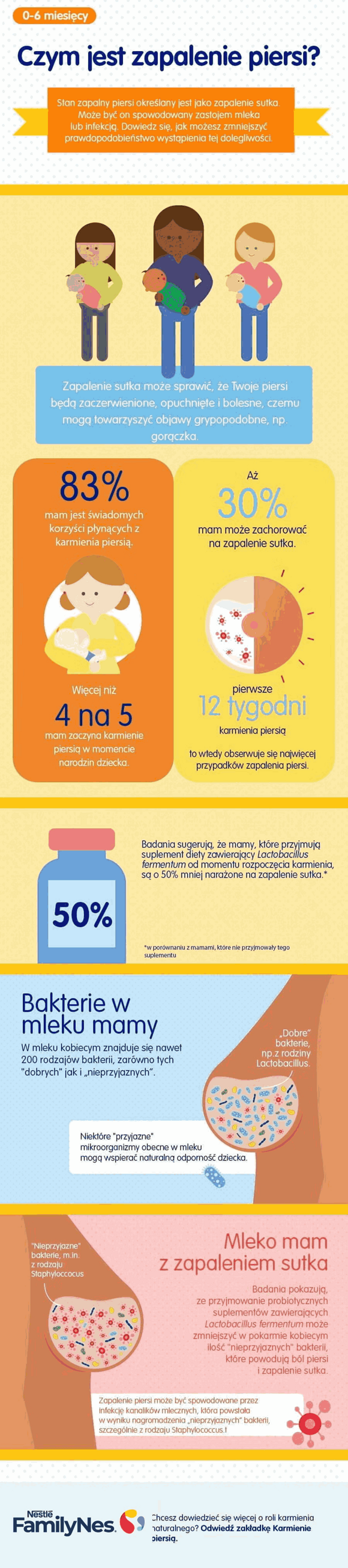 Czym jest zapalenie piersi?