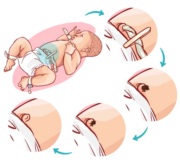 healing process of the peppermint stump healing process of the peppermint stump