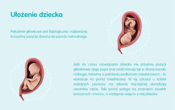 Ułożenie dziecka Ułożenie dziecka