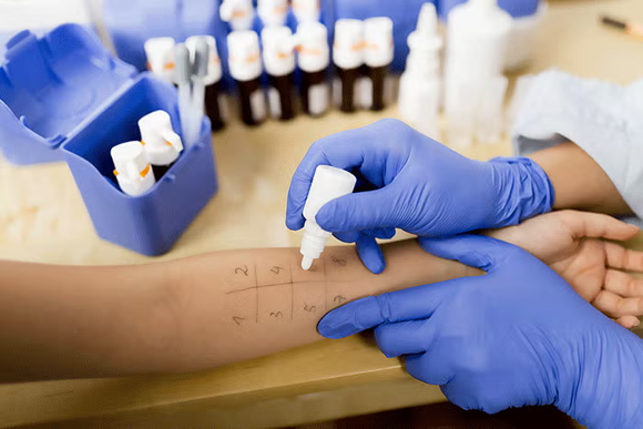 testy skorne testy skorne