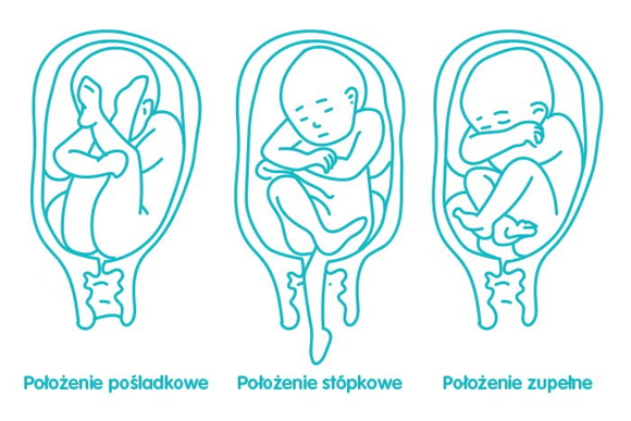 complete post-buttock position
